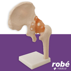 Modèle anatomique de l'articulation de la hanche avec ligaments